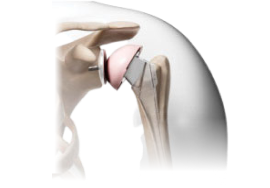 Dr.Rahul Khanna | Best orthopedic in udaipur | Orthopaedic Doctor | Orthopedic surgeon | Joint replacement surgeon | Udaipur | Joint Surgeon | Sports Injury Specialist | Kneeshoulderexpert in Udaipur | rotator cuff pain treatment | knee replacement surgery | top orthopedic doctor in udaipur