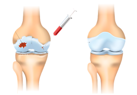 Dr.Rahul Khanna | Best orthopedic in udaipur | Orthopaedic Doctor | Orthopedic surgeon | Joint replacement surgeon | Udaipur | Joint Surgeon | Sports Injury Specialist | Kneeshoulderexpert in Udaipur | rotator cuff pain treatment | knee replacement surgery | top orthopedic doctor in udaipur