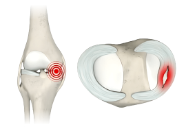 Dr.Rahul Khanna | Best orthopedic in udaipur | Orthopaedic Doctor | Orthopedic surgeon | Joint replacement surgeon | Udaipur | Joint Surgeon | Sports Injury Specialist | Kneeshoulderexpert in Udaipur | rotator cuff pain treatment | knee replacement surgery | top orthopedic doctor in udaipur