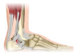 Dr.Rahul Khanna | Best orthopedic in udaipur | Orthopaedic Doctor | Orthopedic surgeon | Joint replacement surgeon | Udaipur | Joint Surgeon | Sports Injury Specialist | Kneeshoulderexpert in Udaipur | rotator cuff pain treatment | knee replacement surgery | top orthopedic doctor in udaipur