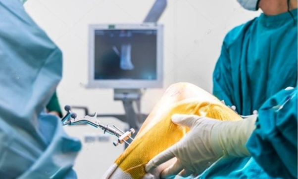 Joint replacement specialist | orthopedic doctor in udaipur | best joint specialist in udaipur | joint replacement specialist in udaipur