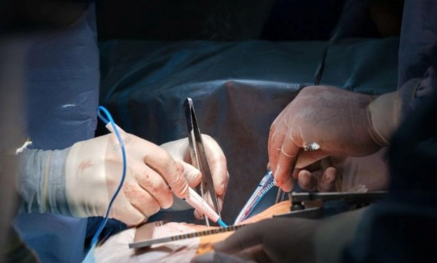 best orthopedic doctor | best orthopedic doctor in Udaipur | rotator cuff repair | rotator cuff pain treatment | rotator cuff pain | shoulder specialist