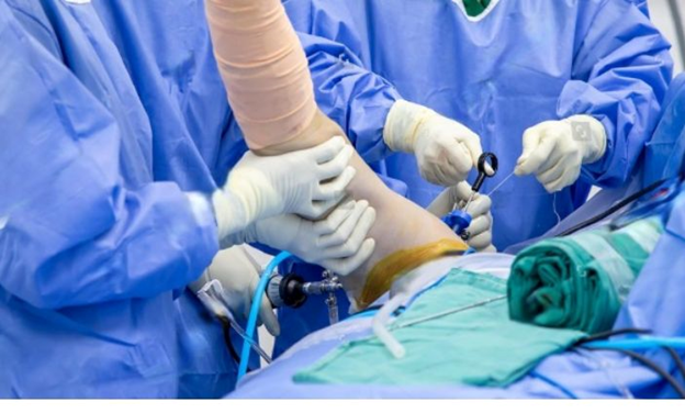 best orthopedic doctor | best orthopedic doctor in Udaipur | rotator cuff repair | rotator cuff pain treatment | rotator cuff pain | shoulder specialist