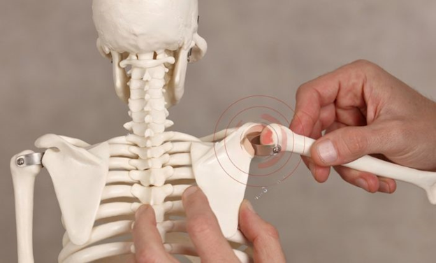 best orthopedic doctor | best orthopedic doctor in Udaipur | rotator cuff repair | rotator cuff pain treatment | rotator cuff pain | shoulder specialist