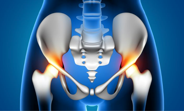 Hip replacement in udaipur | hip replacement doctor in udaipur | orthopedic doctor in udaipur