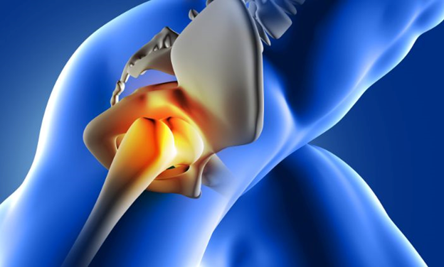 Hip replacement in udaipur | hip replacement doctor in udaipur | orthopedic doctor in udaipur