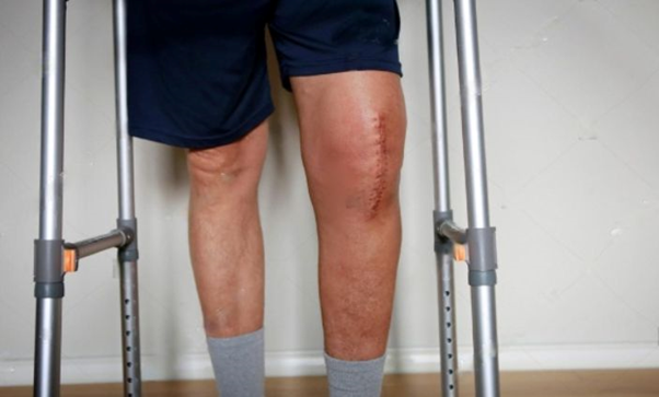 Joint replacement specialist | orthopedic doctor in udaipur | best joint specialist in udaipur | joint replacement specialist in udaipur