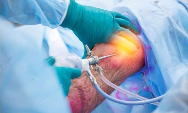 Joint replacement specialist | orthopedic doctor in udaipur | best joint specialist in udaipur | joint replacement specialist in udaipur