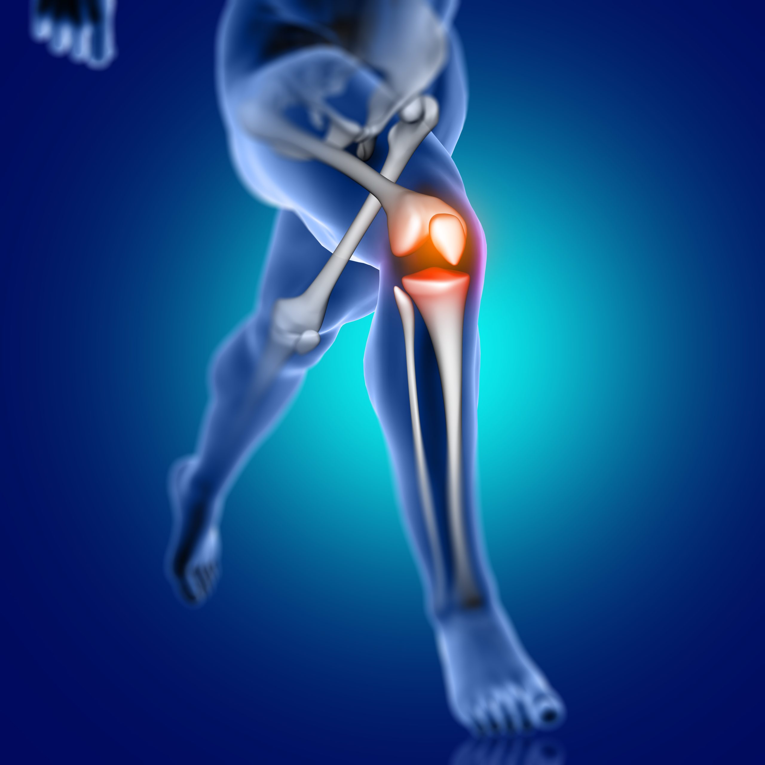 Dr.Rahul Khanna | Best orthopedic in udaipur | Orthopaedic Doctor | Orthopedic surgeon | Joint replacement surgeon | Udaipur | Joint Surgeon | Sports Injury Specialist | Kneeshoulderexpert in Udaipur | rotator cuff pain treatment | knee replacement surgery | top orthopedic doctor in udaipur