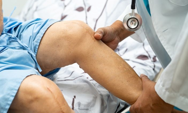 Joint replacement specialist | orthopedic doctor in udaipur | best joint specialist in udaipur | joint replacement specialist in udaipur